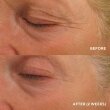 HydroPeptide Eye Authority Інтенсивний ліфтинг-крем для повік, 15мл — Photo 9