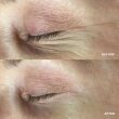 Hydropeptide PolyPeptide Collagel + Mask for eyes Патчі для зони навколо очей — Photo 12