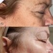 HydroPeptide Vital Eyes Cироватка з миттєвою антивіковою дією, 15мл — Photo 6
