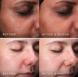 Medik8 Clarity Peptides Очищуючі пептиди з ніацинамідом 10%, 30мл — Photo 9