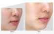 Medi Peel Dr.Deep VC Ultra Cream Крем для сяйва шкіри поживний вітамінний, 50мл — Photo 10
