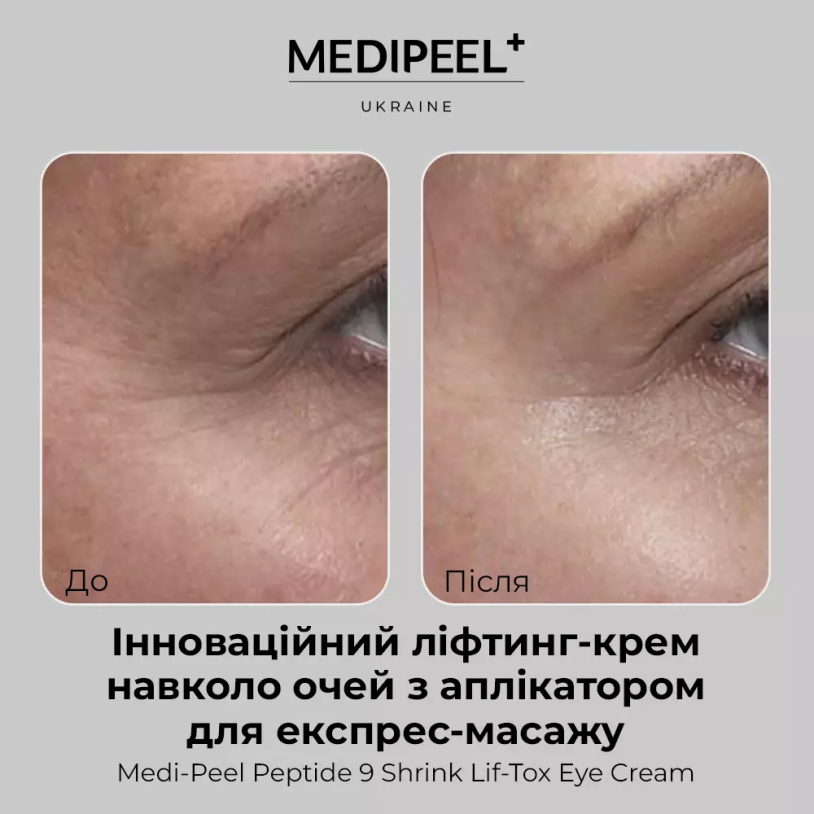 Medi Peel Peptide 9 Shrink Lif-Tox Eye Cream Зміцнюючий ліфтінг крем для шкіри навколо очей 20мл — Photo 6
