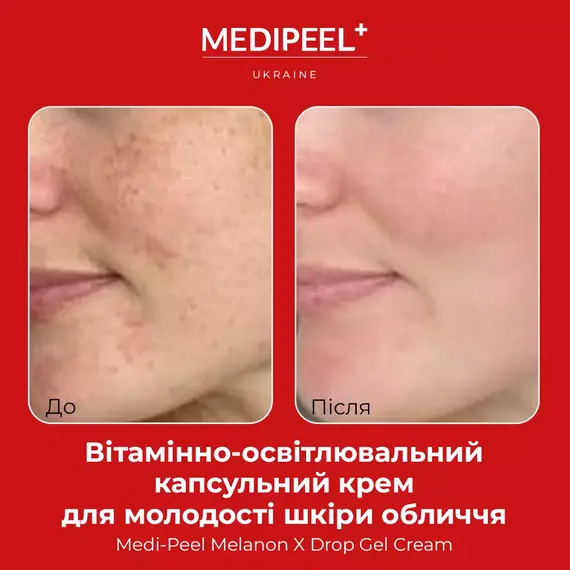 Medi Peel Melanon X Drop Gel Cream Капсульний крем-гель із ретинолом 50мл — Photo 4