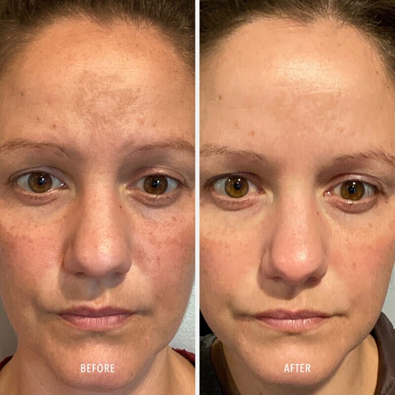 HydroPeptide Firma-Bright – Зміцнюючий засіб для сяяння, освітлення і захисту шкіри, 30мл — Photo 3