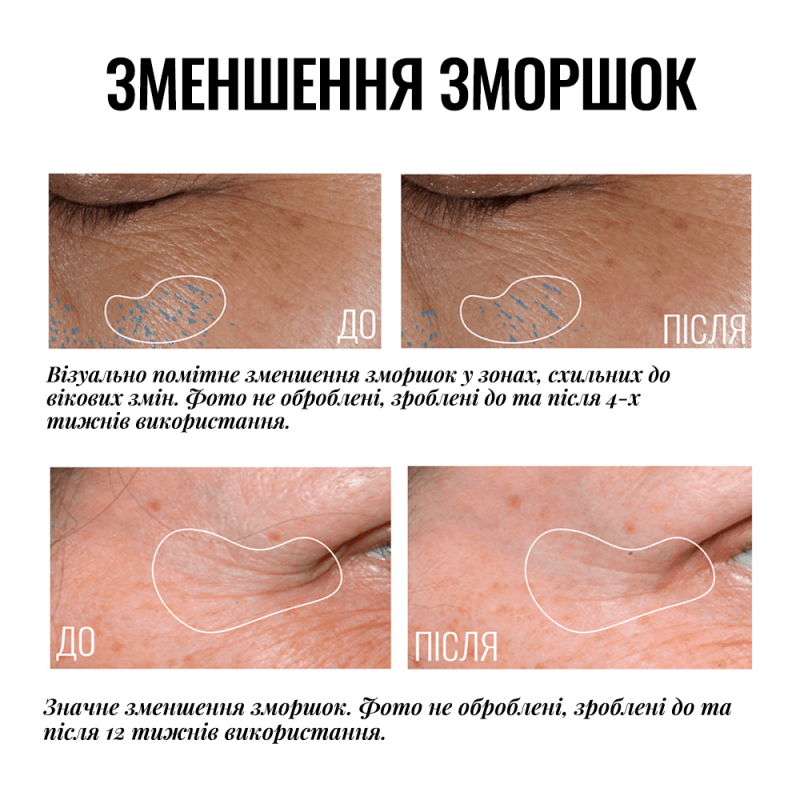 Instytutum Truly-Transforming Brightening Eye Cream Крем ліфтинг для повік з освітлювальним ефектом, 15мл — Photo 2