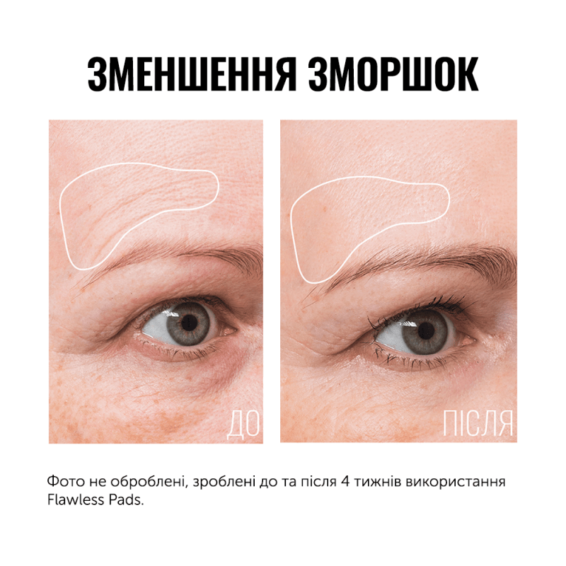 Instytutum Flawless Pads Подушечки з кислотами для глибокого відновлення шкіри 60шт — Photo 2