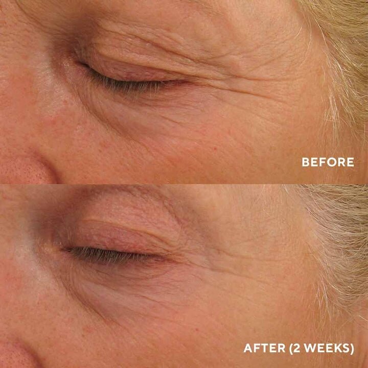 HydroPeptide Eye Authority Інтенсивний ліфтинг-крем для повік, 15мл — Photo 5