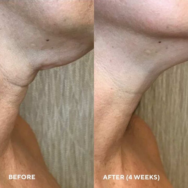 HydroPeptide Firm-A-Fix Nectar Ліфтинг-сироватка для шиї та декольте, 50мл — Photo 7