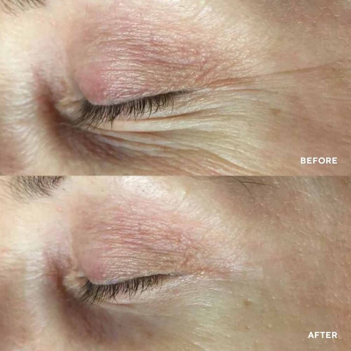 Hydropeptide PolyPeptide Collagel + Mask for eyes Патчі для зони навколо очей — Photo 6