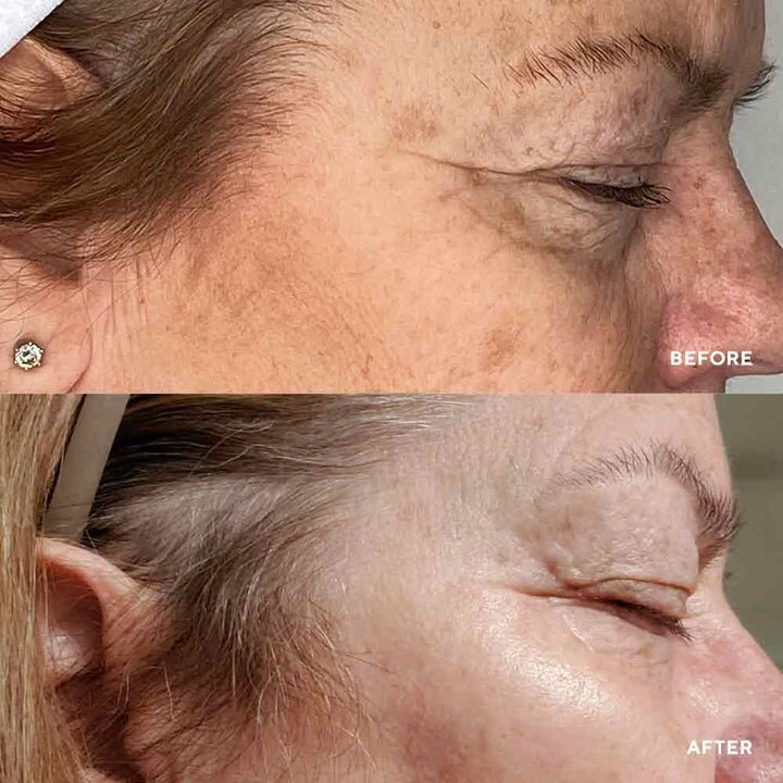 HydroPeptide Vital Eyes Cироватка з миттєвою антивіковою дією, 15мл — Photo 3