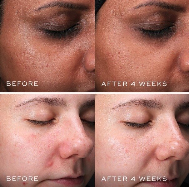 Medik8 Clarity Peptides Очищуючі пептиди з ніацинамідом 10%, 30мл — Photo 5