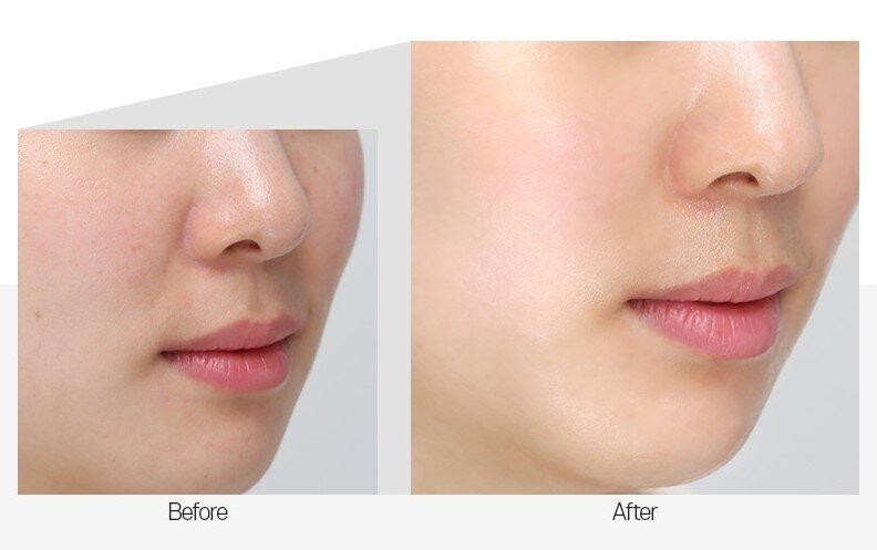 Medi Peel Dr.Deep VC Ultra Cream Крем для сяйва шкіри поживний вітамінний, 50мл — Photo 5
